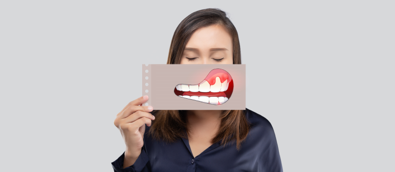 Mouth Oral Cancer